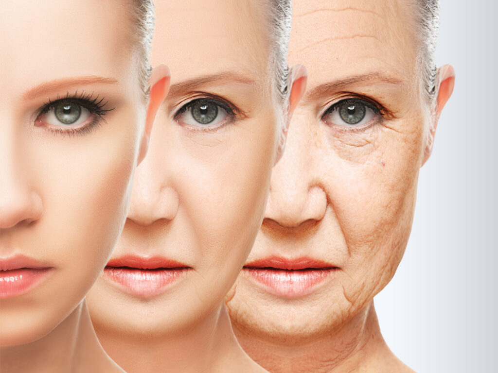 Stave Off Wrinkles with a Low Sugar Diet