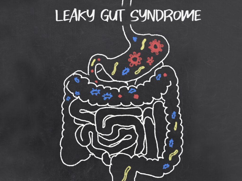 How Gluten Promotes Leaky Gut (Even if You are NOT Gluten Sensitive)