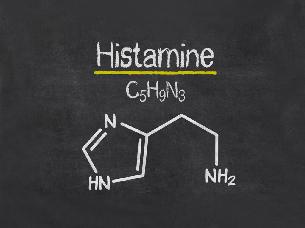 How to Hack Your Histamine Intolerance