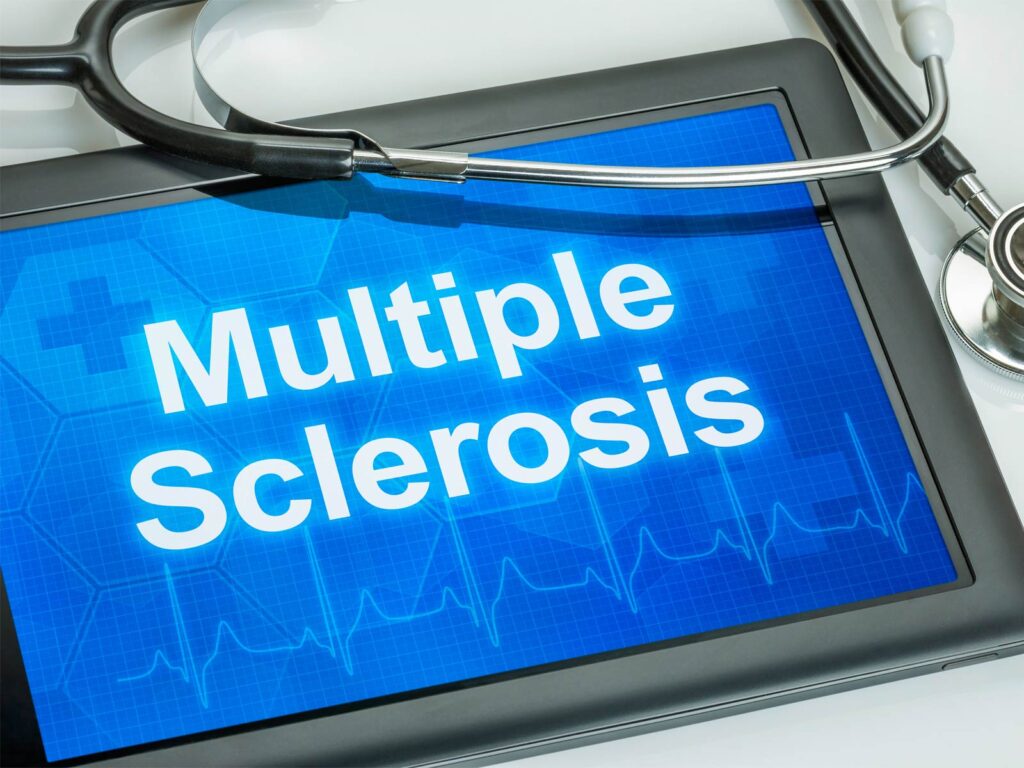 The Keto Diet – Promising Nutritional Therapy for MS