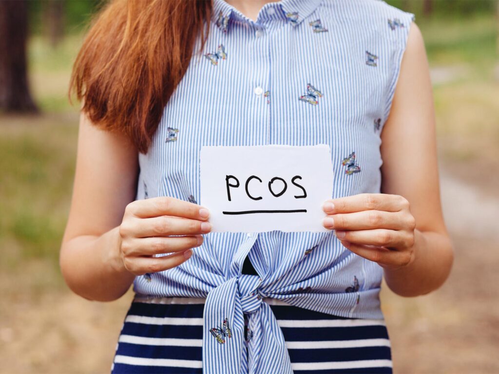 The Keto Diet for PCOS