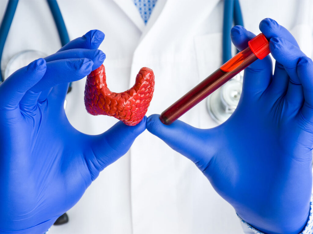 The Connection Between Thyroid Disease and Inflammation