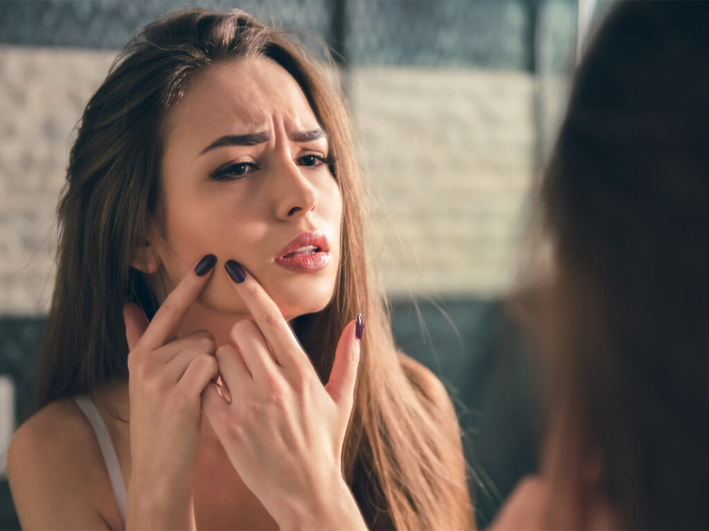 Heal Acne with a Personalized Diet