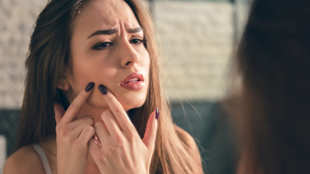 Heal Acne with a Personalized Diet